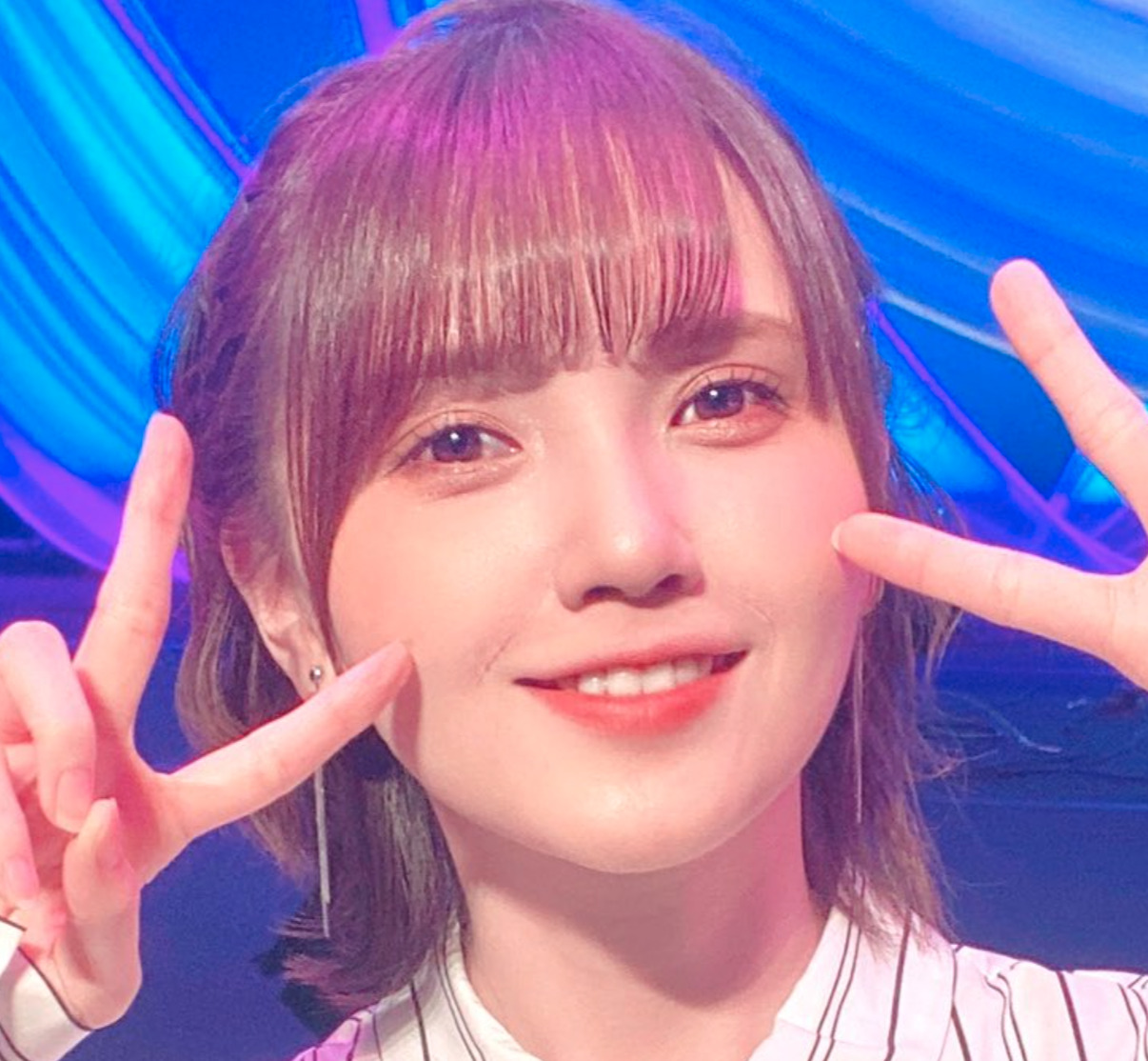 川栄李奈の整形疑惑
